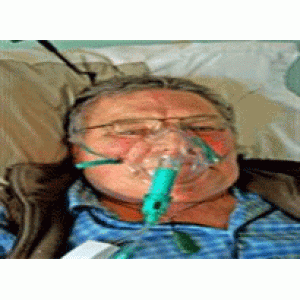10 dấu hiệu cảnh báo đợt cấp COPD