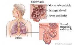 Các bệnh đồng mắc COPD