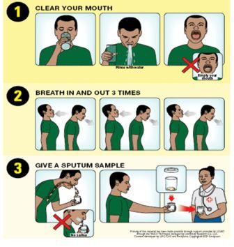 Hướng dẫn cách lấy đàm đúng cho bệnh nhân