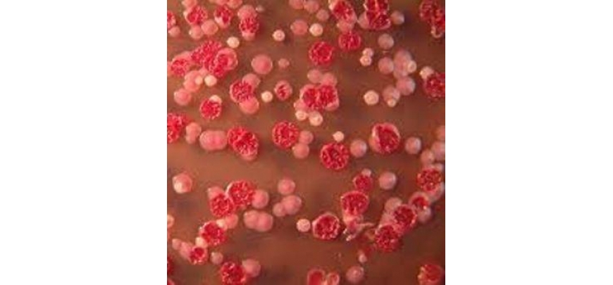 Bệnh Melioidosis