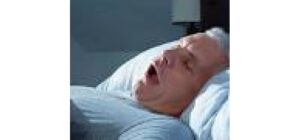 Hội chứng ngưng thở khi ngủ