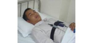 Tỷ lệ mắc hội chứng ngưng thở khi ngủ ở Việt Nam rất cao