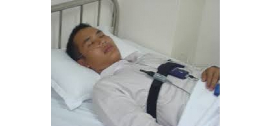 Tỷ lệ mắc hội chứng ngưng thở khi ngủ ở Việt Nam rất cao