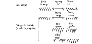 Hình ảnh sóng giấc ngủ